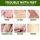 Foot Cream Heel Repair Horse Oil Cream Smooth Removal Dead Skin Callus Anti-Drying Hand Feet Skin Care 30g