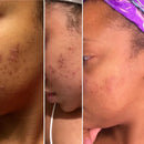 Extra Strength Turmeric Black Soap