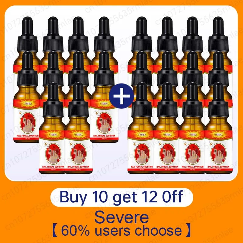 7 أيام من إصلاح الزيت الأساسي للونجل، منتجات من الجلد لعلاج فطريات الأظافر