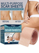 Pegatinas para ocultar tatuajes, transpirables e impermeables, para cubrir la piel, parche adhesivo para ocultar imperfecciones del tatuaje