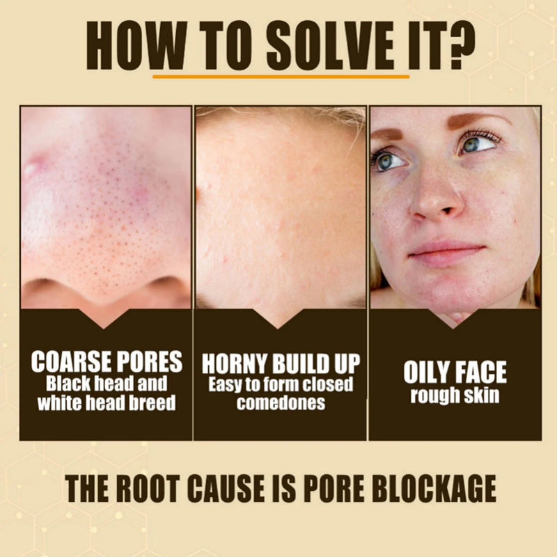 Rosehip Oil Moisturizing&Brightening Essential Oil Moisturizing&Wrinkling Facial essence