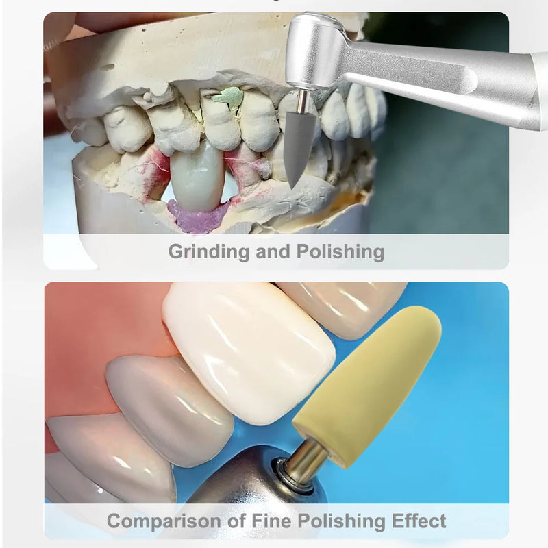 HP0412 12pcs/Kit Dental Resin Base Hidden Denture Polishing Kits for Low Speed Contra Angle Handpiece Denspay Dentistry Tools