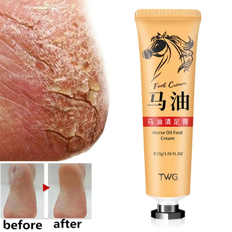 Foot Cream Heel Repair Horse Oil Cream Smooth Removal Dead Skin Callus Anti-Drying Hand Feet Skin Care 30g
