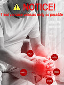 Powerful Laser Therapy venous inflammation sell like hot cakes