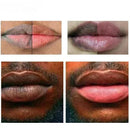 Fast Lightening Lips Serum Bleaching Permanent Pink Mouth Pink Moisturizing Lighten Dark Lip Balm Gloss Lipstick Lip Serum