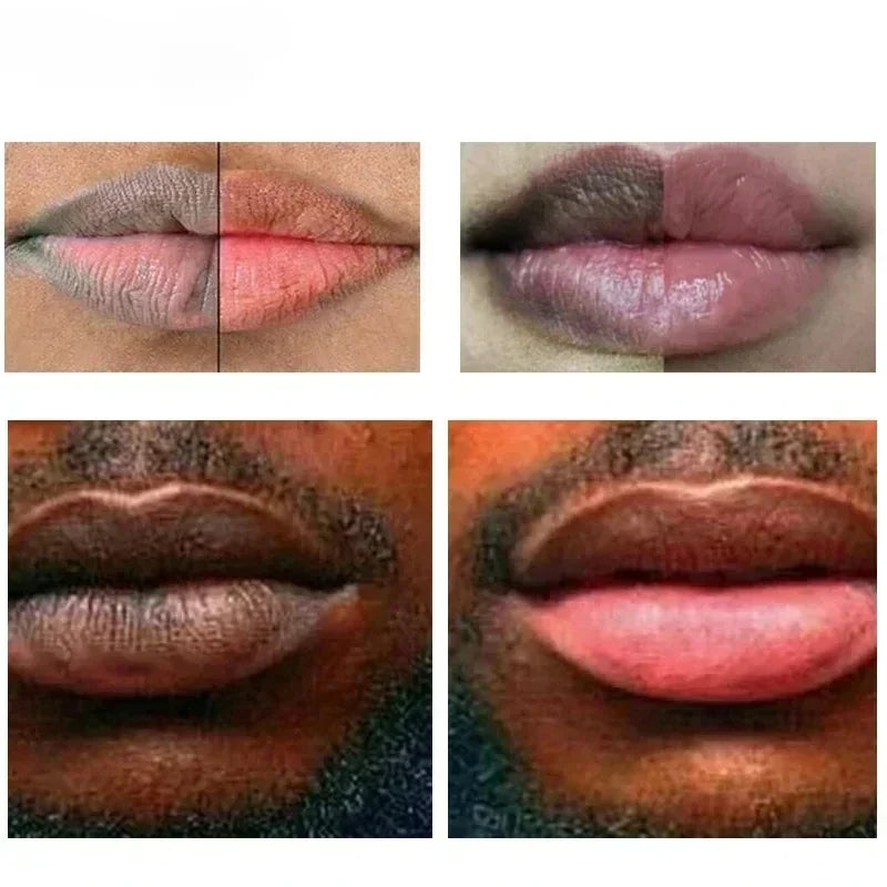 Fast Lightening Lips Serum Bleaching Permanent Pink Mouth Pink Moisturizing Lighten Dark Lip Balm Gloss Lipstick Lip Serum