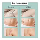 Pegatinas para ocultar tatuajes, transpirables e impermeables, para cubrir la piel, parche adhesivo para ocultar imperfecciones del tatuaje