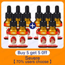 7 أيام من إصلاح الزيت الأساسي للونجل، منتجات من الجلد لعلاج فطريات الأظافر