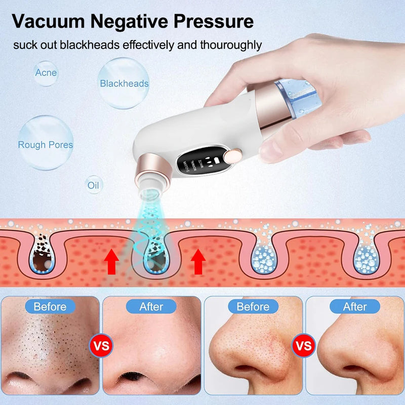 Electric Blackhead Remover Vacuum Bubble Water Cycle Face Hydro Dead Skin Beauty Acne Cleaner Pore Suction Vacuum Removal Device