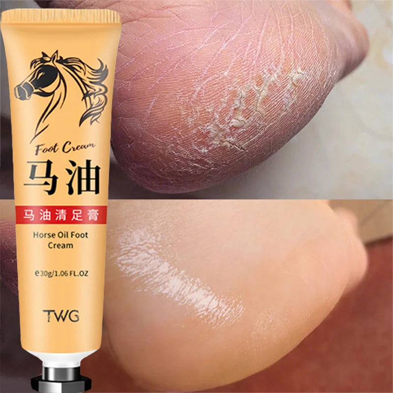 Foot Cream Heel Repair Horse Oil Cream Smooth Removal Dead Skin Callus Anti-Drying Hand Feet Skin Care 30g