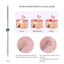 1PC Blackhead Acne Needle Stainless Steel Acne Remove Tweezer  Blackhead Extractor Pimple Tweezer Face Pore Cleanering Care Tool