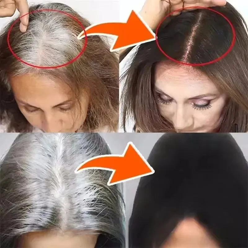 Gray White Hair Treatment Serum Soap Fast White To Black Repair Nourish Beard Hair Roots Shampoo Men Women Beauty Health Care