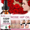 Rosehip Oil Moisturizing&Brightening Essential Oil Moisturizing&Wrinkling Facial essence