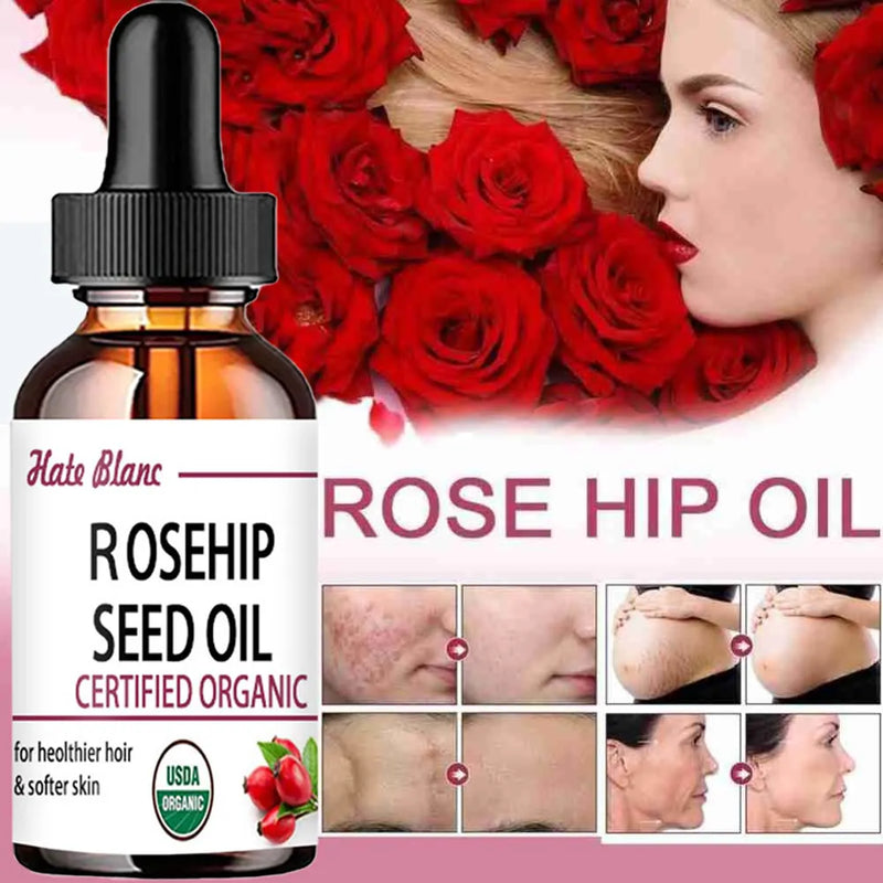 Rosehip Oil Moisturizing&Brightening Essential Oil Moisturizing&Wrinkling Facial essence