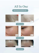 Professional Permanent Laser Depilator IPL Hair Removal For Whole Body, Depilator Remover Permanent Women Home Use Devices