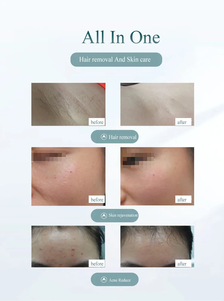 Professional Permanent Laser Depilator IPL Hair Removal For Whole Body, Depilator Remover Permanent Women Home Use Devices