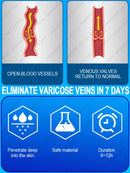 Powerful Laser Therapy venous inflammation sell like hot cakes