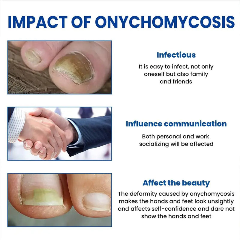 60 pegatinas para el tratamiento de hongos en las uñas de los pies, eliminación de paroniquia, corrección de uñas encarnadas, herramientas de pedicura.