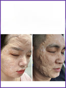 Liquid Thread Lift Mask for Lifting and Firming